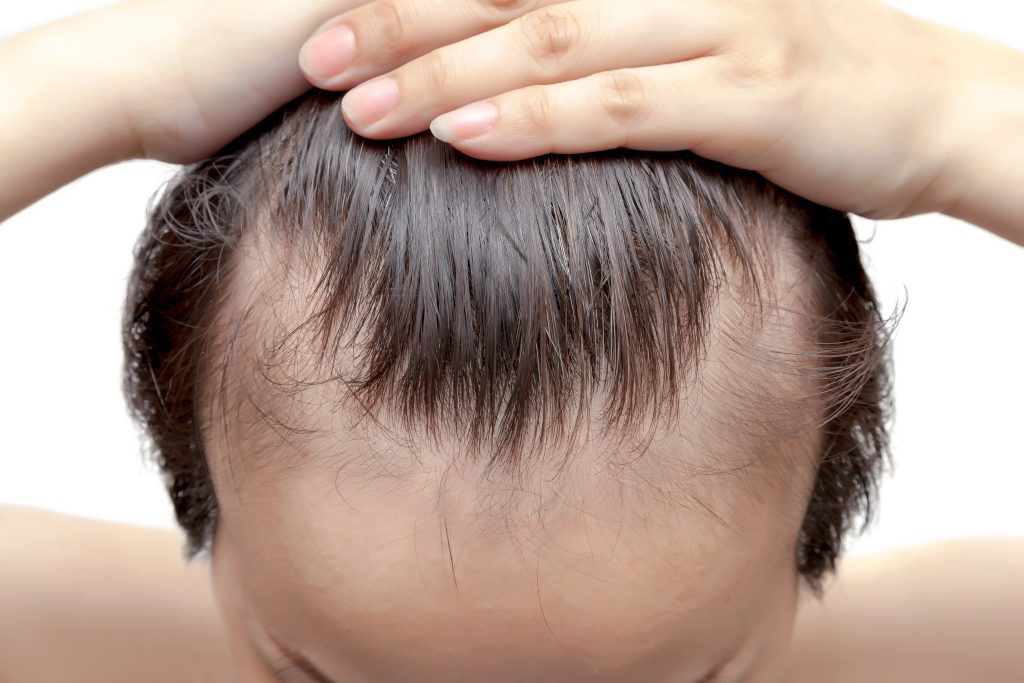 Hair Loss Treatment for Men in Beverly Hills
