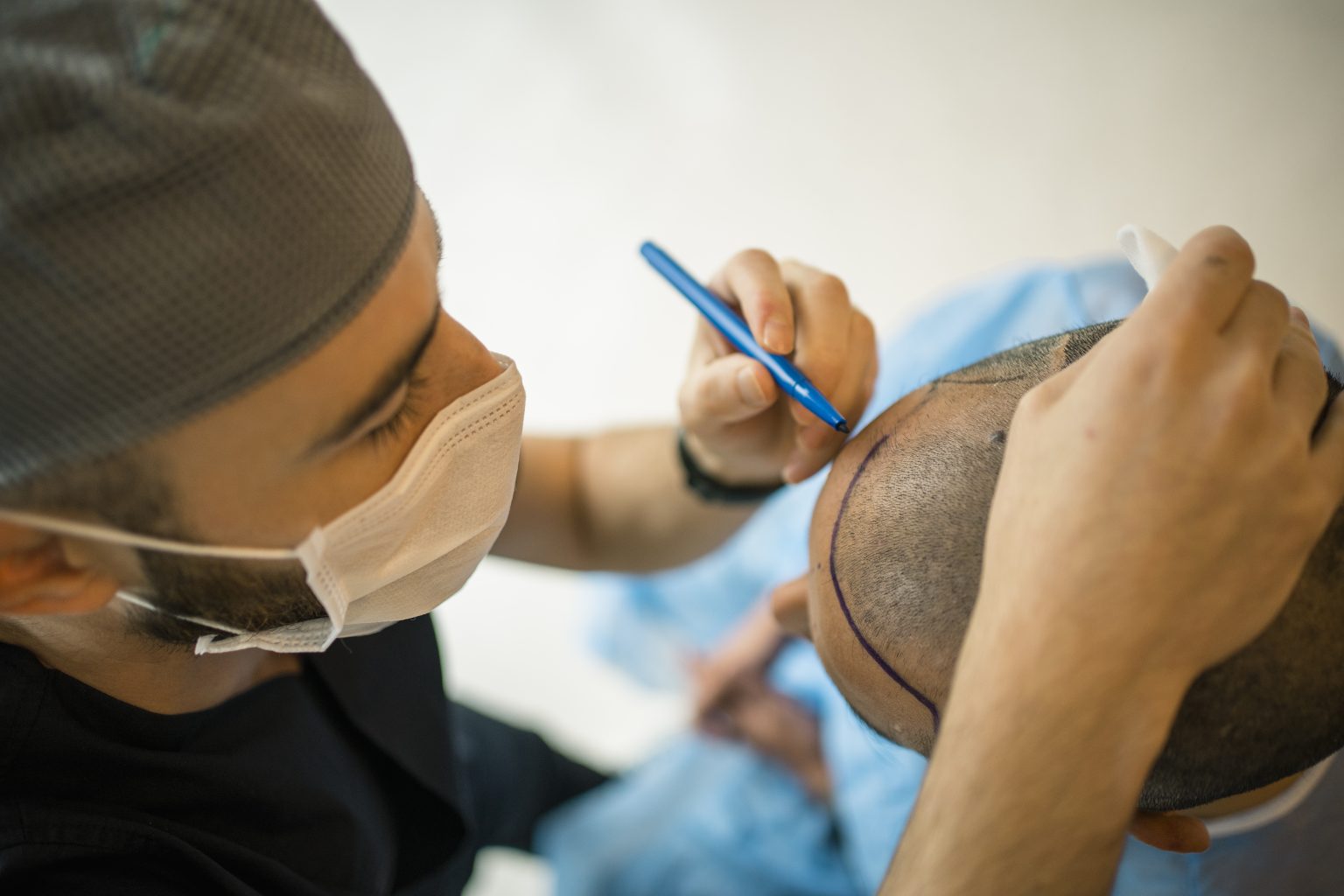 Best Hair Transplant Specialist in Thousand Oaks